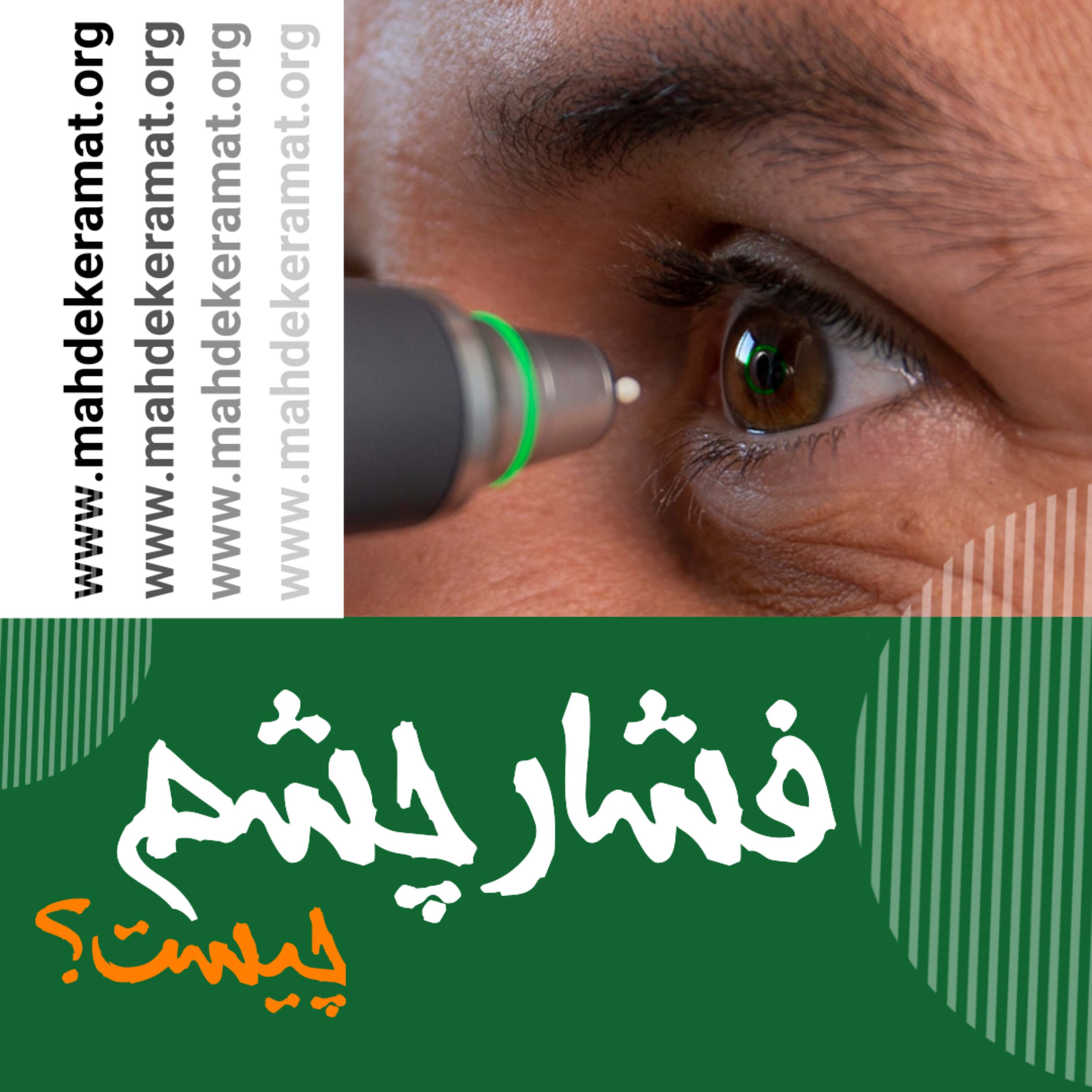 فشار چشم چگونه بوجود می آید؟